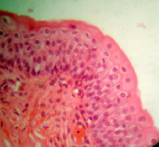 Transitionsl Epithelium From the Bladder