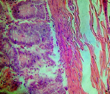 Simple Columnar Epithelium on the left