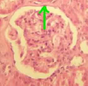 simple squamous epithelium in kidney
