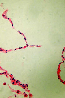 Simple Squamous Epithelium From the Lung