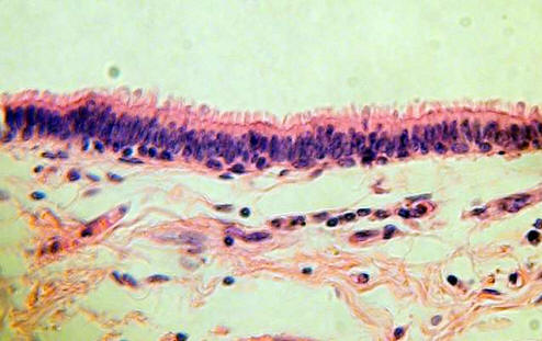 Pseudostratitifed Epithelium From the Lungs
