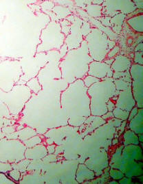 Simple Squamous Epithelium from the Lung