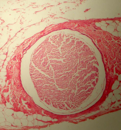 Cross-section of a Nerve
