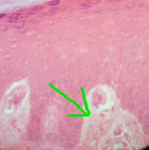 Areolar Connective Tissue in Skin
