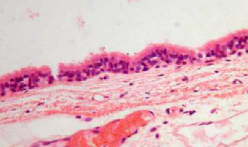 Pseudostratified Epithelium In Trachea
