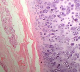 hyaline cartilage of the trachea low power