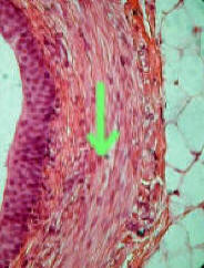 Smooth Muscle From Ureter