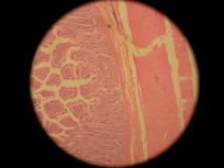 Colon 100x