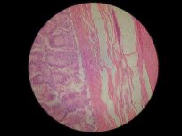 Colon 400x