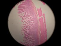 Colon 40x