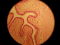 Esophagus 100x