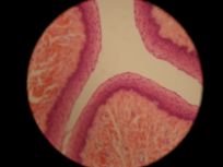Esophagus 400x