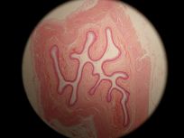 Esophagus 40x