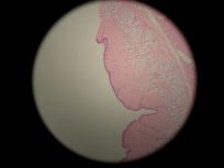 Esophagus 40x
