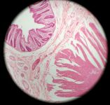Colon 100x