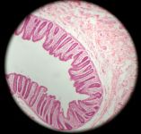Colon 100x