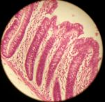 Colon 400x