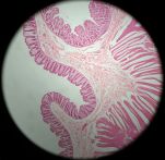Colon 40x