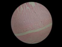 duodenum 100x (duodenal glands)