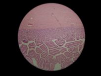 duodenum 400x (duodenal glands)