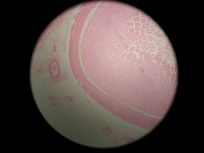 Duodenum 40x (All Layers)