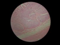 Ileum 100x (Peyer's Patches