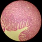 Stomach 100x (pits + glands)