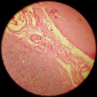 Stomach 100x (submucosa)