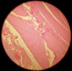 Stomach 100x (muscularis externa)