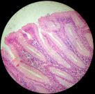 Stomach 400x (gastric pits)