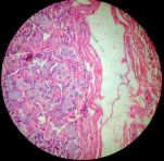 Stomach 400x (muscularis mucosa)